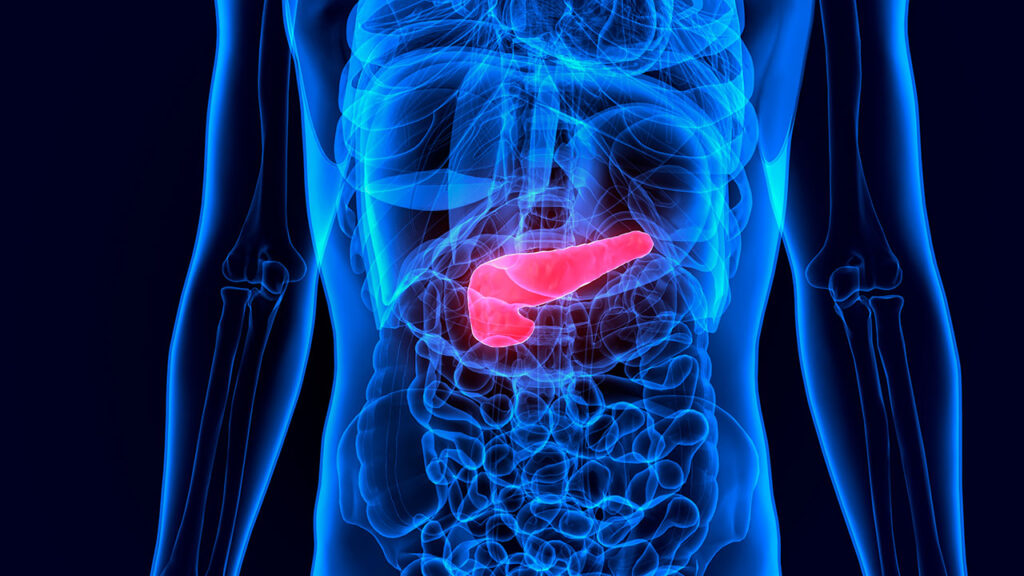 cancer de pancreas
